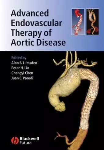 Advanced Endovascular Therapy of Aortic Disease cover