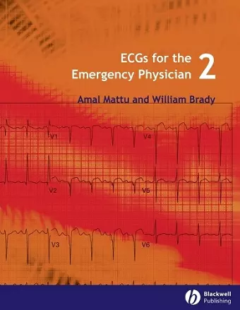 ECGs for the Emergency Physician 2 cover