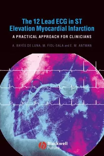 The 12 Lead ECG in ST Elevation Myocardial Infarction cover