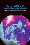 The 12 Lead ECG in ST Elevation Myocardial Infarction cover