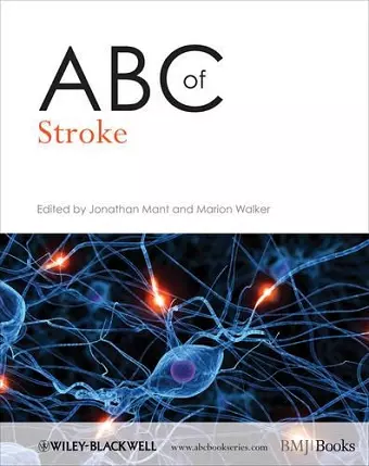 ABC of Stroke cover