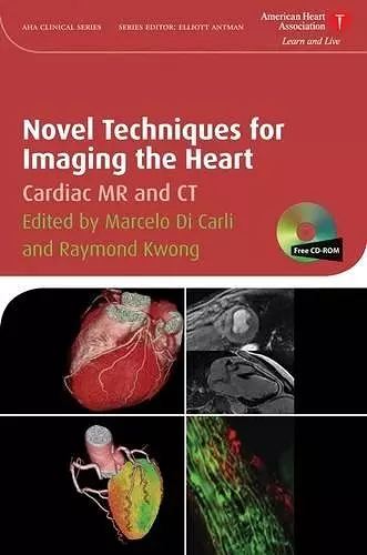 Novel Techniques for Imaging the Heart cover