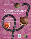 Colonoscopy cover