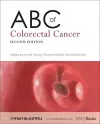 ABC of Colorectal Cancer cover