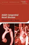 Adult Congenital Heart Disease cover