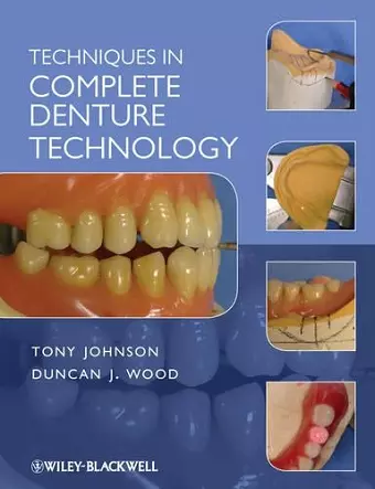 Techniques in Complete Denture Technology cover