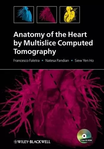 Anatomy of the Heart by Multislice Computed Tomography cover