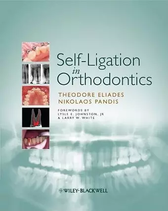 Self-Ligation in Orthodontics cover