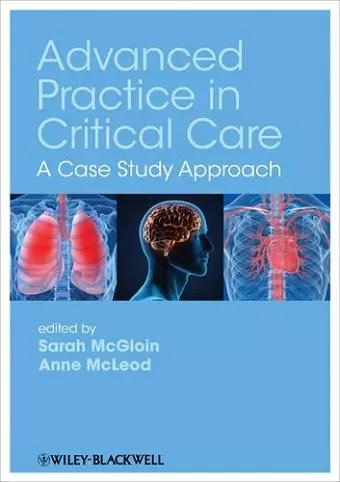 Advanced Practice in Critical Care cover