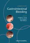 Gastrointestinal Bleeding cover