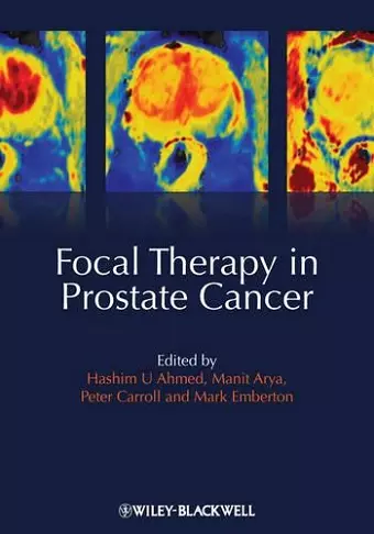 Focal Therapy in Prostate Cancer cover