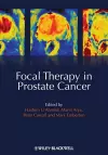 Focal Therapy in Prostate Cancer cover