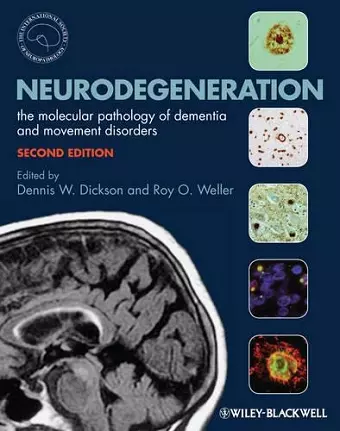 Neurodegeneration cover