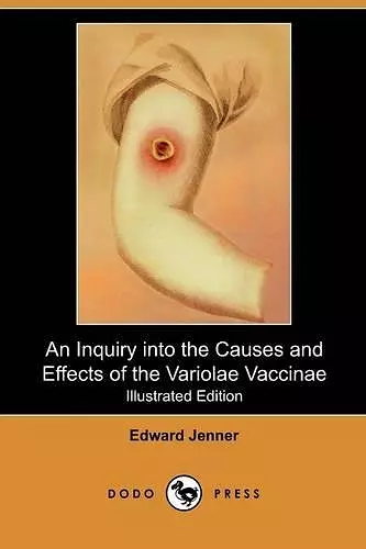 An Inquiry Into the Causes and Effects of the Variolae Vaccinae cover