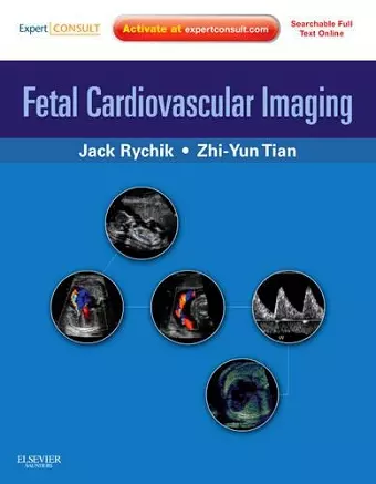 Fetal Cardiovascular Imaging: A Disease Based Approach cover