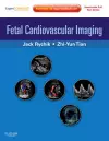 Fetal Cardiovascular Imaging: A Disease Based Approach cover