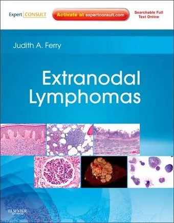 Extranodal Lymphomas cover