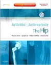 Arthritis and Arthroplasty: The Hip cover