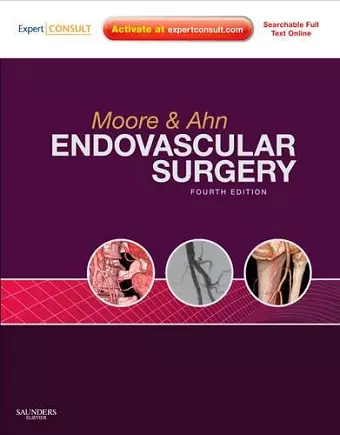 Endovascular Surgery cover