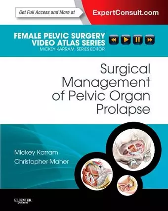 Surgical Management of Pelvic Organ Prolapse cover