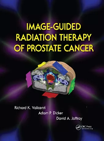 Image-Guided Radiation Therapy of Prostate Cancer cover