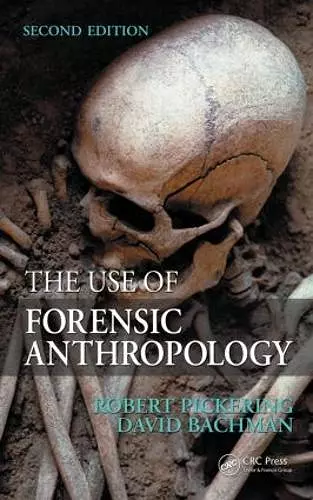 The Use of Forensic Anthropology cover