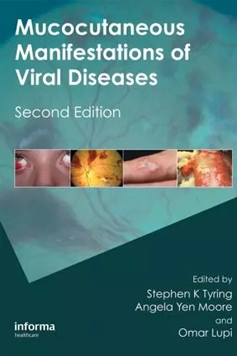 Mucocutaneous Manifestations of Viral Diseases cover