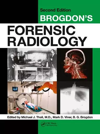 Brogdon's Forensic Radiology cover