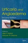 Urticaria and Angioedema cover