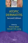 Atopic Dermatitis cover