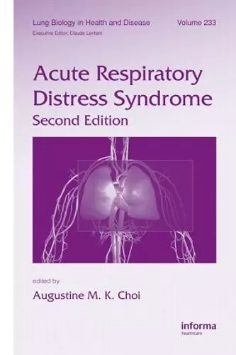 Acute Respiratory Distress Syndrome cover