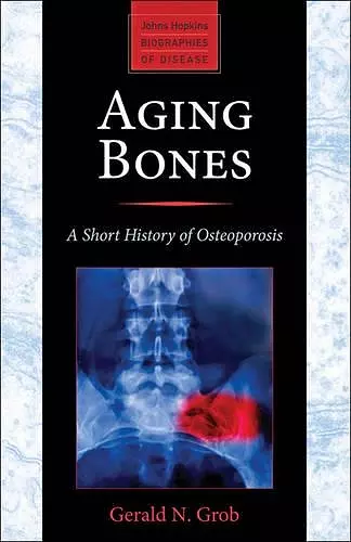 Aging Bones cover