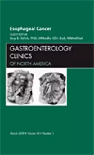 Esophageal Cancer, An Issue of Gastroenterology Clinics cover