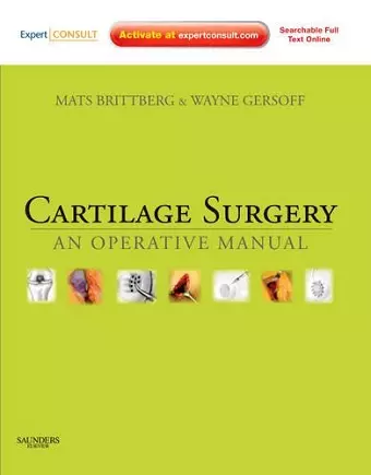 Cartilage Surgery cover