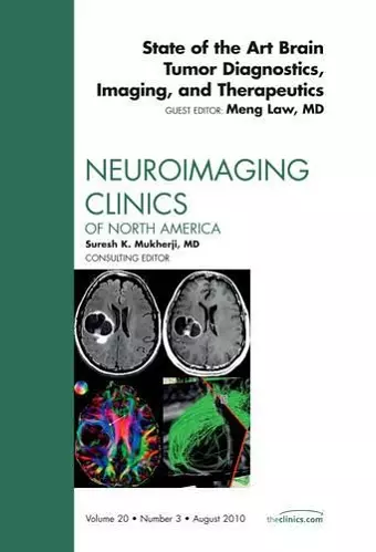 State of the Art Brain Tumor Diagnostics, Imaging, and Therapeutics, An Issue of Neuroimaging Clinics cover