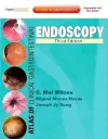 Atlas of Clinical Gastrointestinal Endoscopy cover