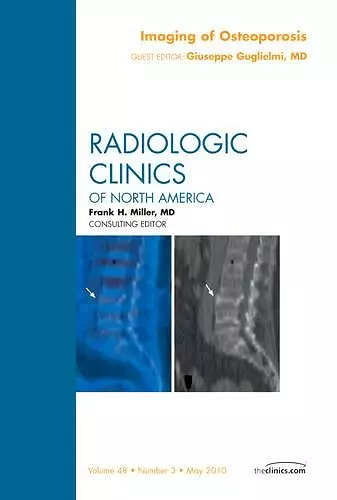 Imaging of Osteoporosis, An Issue of Radiologic Clinics of North America cover