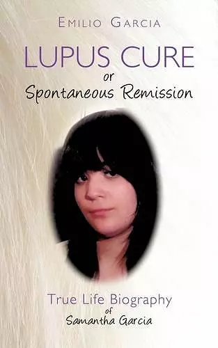 Lupus Cure or Spontaneous Remission cover