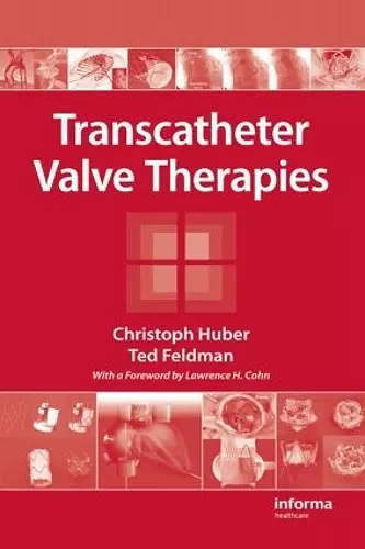 Transcatheter Valve Therapies cover