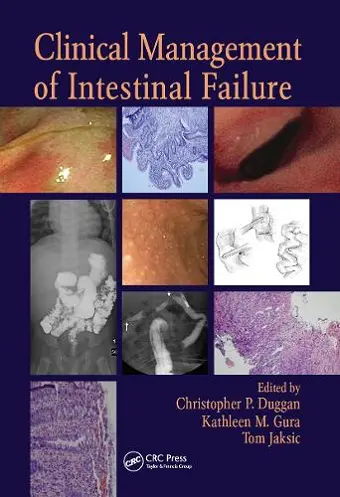 Clinical Management of Intestinal Failure cover