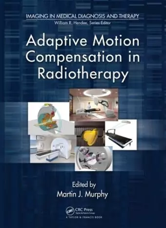 Adaptive Motion Compensation in Radiotherapy cover