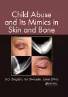 Child Abuse and its Mimics in Skin and Bone cover