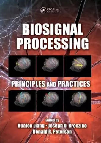 Biosignal Processing cover