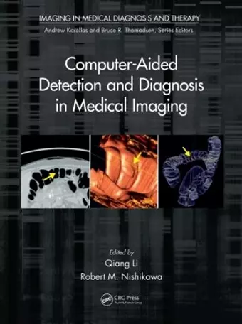 Computer-Aided Detection and Diagnosis in Medical Imaging cover