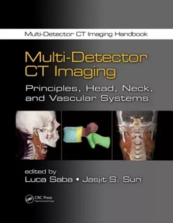 Multi-Detector CT Imaging cover