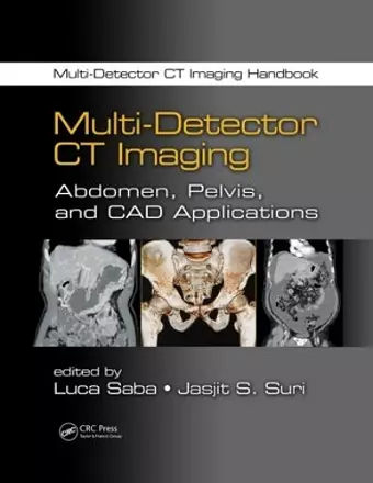 Multi-Detector CT Imaging cover