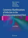 Cutaneous Manifestations of Infection in the Immunocompromised Host cover