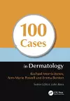 100 Cases in Dermatology cover