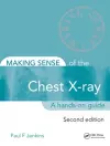 Making Sense of the Chest X-ray cover