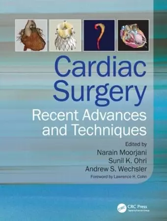 Cardiac Surgery cover